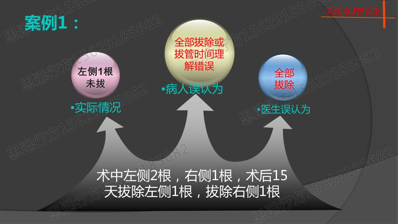 案例1，全部拔除或拔管时间理解错误